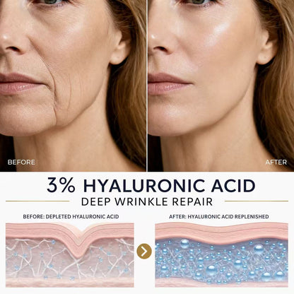 💧 3% Hyaluronic Acid Ultra-Hydrating Serum Flood Your Skin With Glass-Skin Hydration Instantly ✨