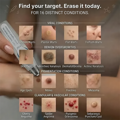 AQA® 𝟕-𝐃𝒂𝘆 𝐒𝗸𝐢𝐧 𝐓𝒂𝗴 𝐒𝐩𝙤𝐭 𝐄𝐫𝒂𝐬𝙚𝐫 Painless Scar-Free