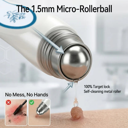 AQA® 𝟕-𝐃𝒂𝘆 𝐒𝗸𝐢𝐧 𝐓𝒂𝗴 𝐒𝐩𝙤𝐭 𝐄𝐫𝒂𝐬𝙚𝐫 Painless Scar-Free