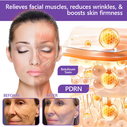 Vaxflite® PDRN Multi-Peptide Massaging Body Roller Cream- Anti-aging, Hydrating, Skin Firming & Lifting, Skin Repair, Even Tone, Acne and Dark Spot Treatment, Wart and Mole Removal, and Psoriasis Relief⭐