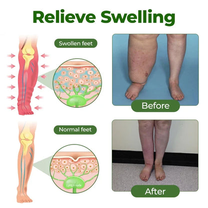 Leg Circulation Cream