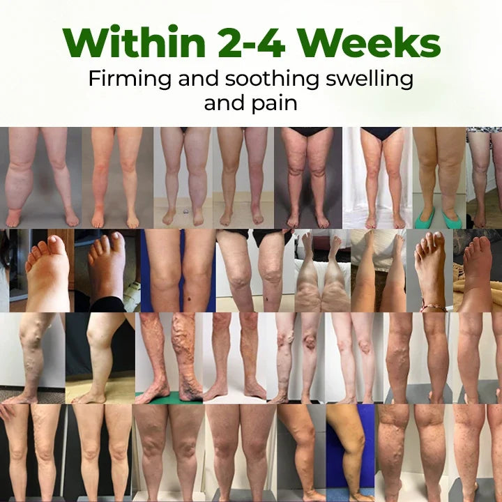 Leg Circulation Cream
