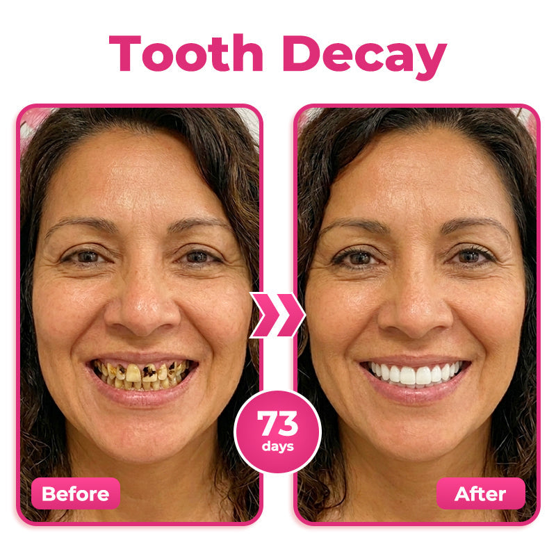 HZA® Thismile NH-10 Enamel & Gum Advanced Therapy Toothpaste Serum