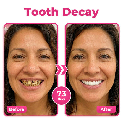 HZA® Thismile NH-10 Enamel & Gum Advanced Therapy Toothpaste Serum