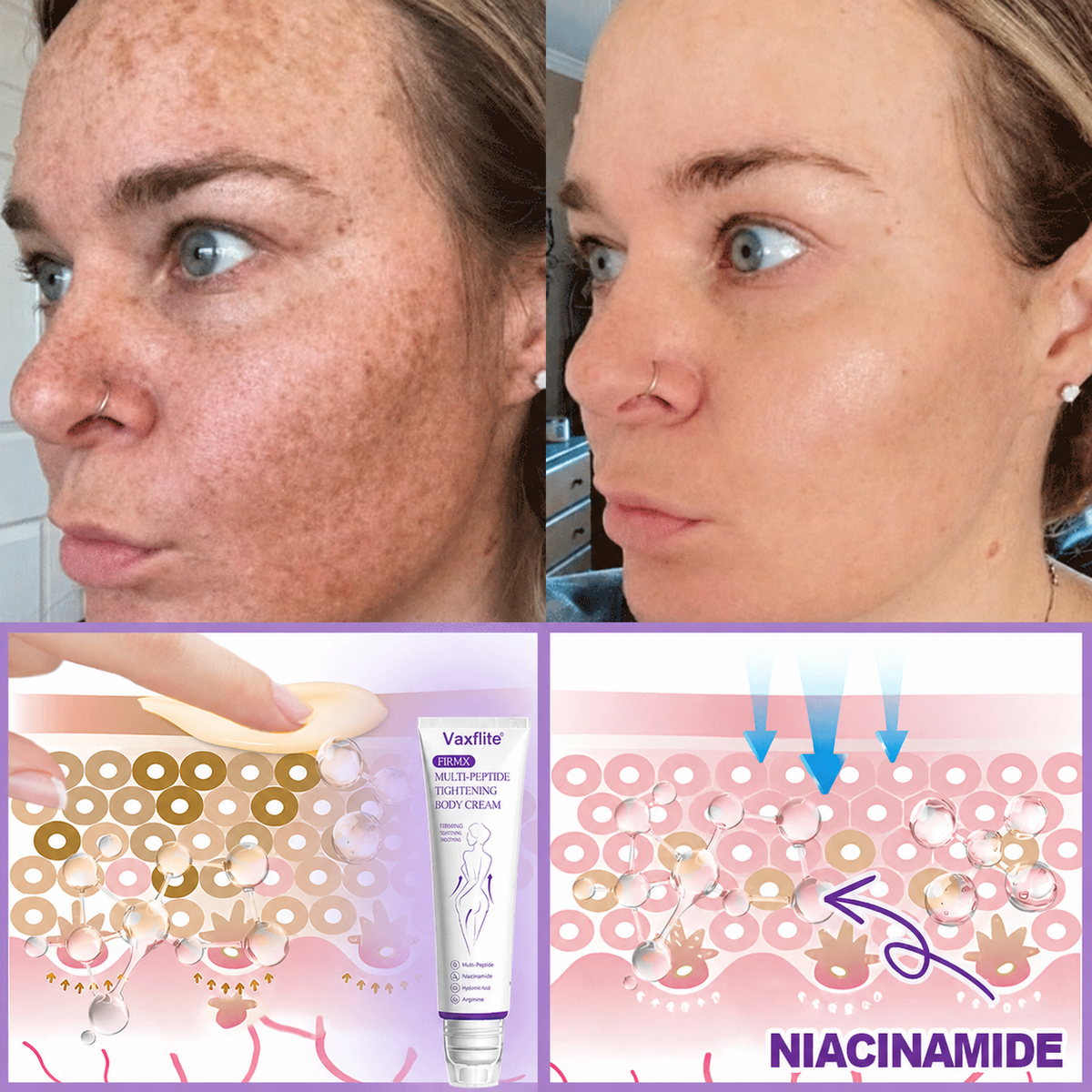 Vaxflite® PDRN Multi-Peptide Massaging Body Roller Cream- Anti-aging, Hydrating, Skin Firming & Lifting, Skin Repair, Even Tone, Acne and Dark Spot Treatment, Wart and Mole Removal, and Psoriasis Relief⭐