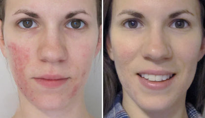 48H Redness Relief Cream – Calm & Restore Sensitive Skin