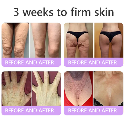 Vaxflite® PDRN Multi-Peptide Massaging Body Roller Cream- Anti-aging, Hydrating, Skin Firming & Lifting, Skin Repair, Even Tone, Acne and Dark Spot Treatment, Wart and Mole Removal, and Psoriasis Relief⭐