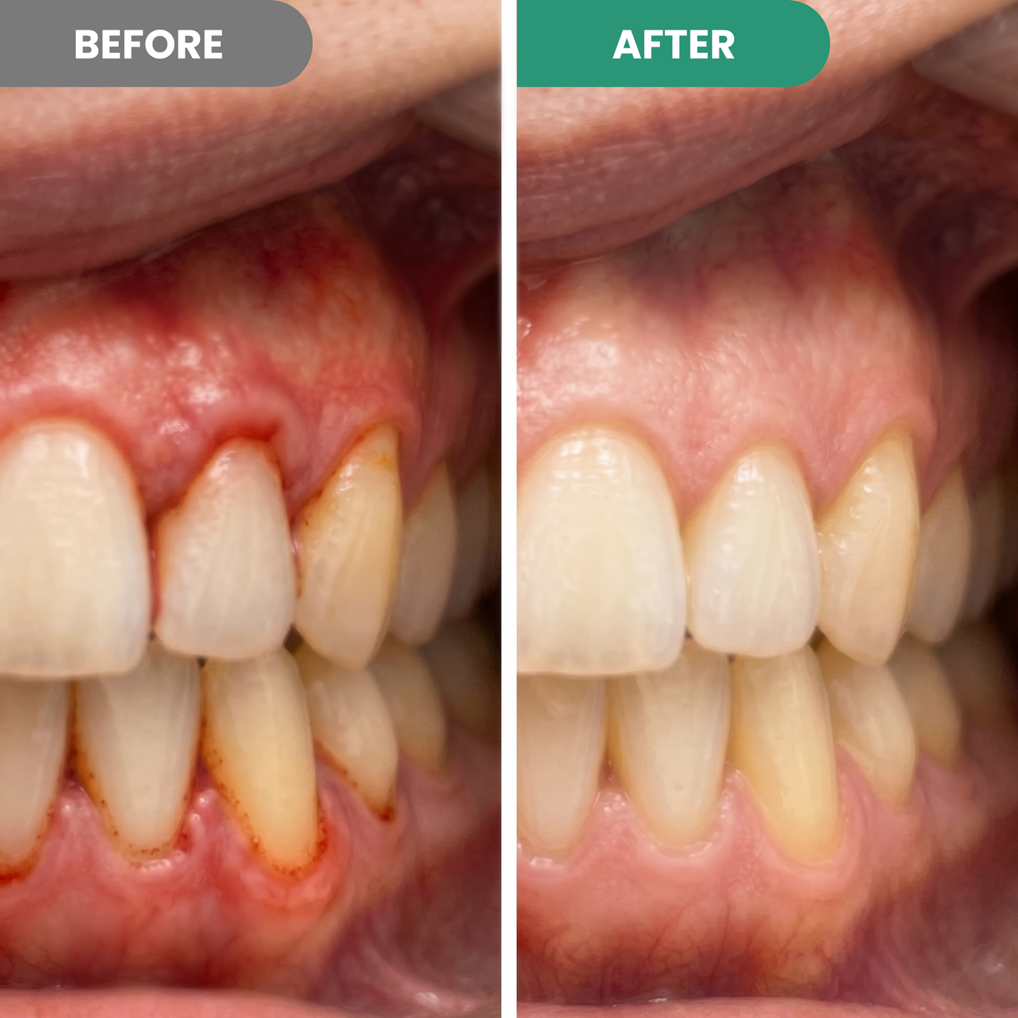 🔥 Pawzioo™ Gum & Enamel Repair Pen – Soothe Sensitive Gums & Support a Healthier Smile