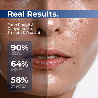 💧 3% Hyaluronic Acid Ultra-Hydrating Serum Flood Your Skin With Glass-Skin Hydration Instantly ✨