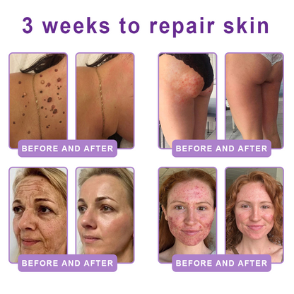 Vaxflite® PDRN Multi-Peptide Massaging Body Roller Cream- Anti-aging, Hydrating, Skin Firming & Lifting, Skin Repair, Even Tone, Acne and Dark Spot Treatment, Wart and Mole Removal, and Psoriasis Relief⭐