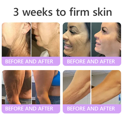 Vaxflite® PDRN Multi-Peptide Massaging Body Roller Cream- Anti-aging, Hydrating, Skin Firming & Lifting, Skin Repair, Even Tone, Acne and Dark Spot Treatment, Wart and Mole Removal, and Psoriasis Relief⭐