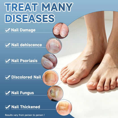 3-Day Maximum Intensity Nail Fungus Treatment - Fast-Acting Liquid Drops