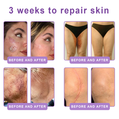 Vaxflite® PDRN Multi-Peptide Massaging Body Roller Cream- Anti-aging, Hydrating, Skin Firming & Lifting, Skin Repair, Even Tone, Acne and Dark Spot Treatment, Wart and Mole Removal, and Psoriasis Relief⭐