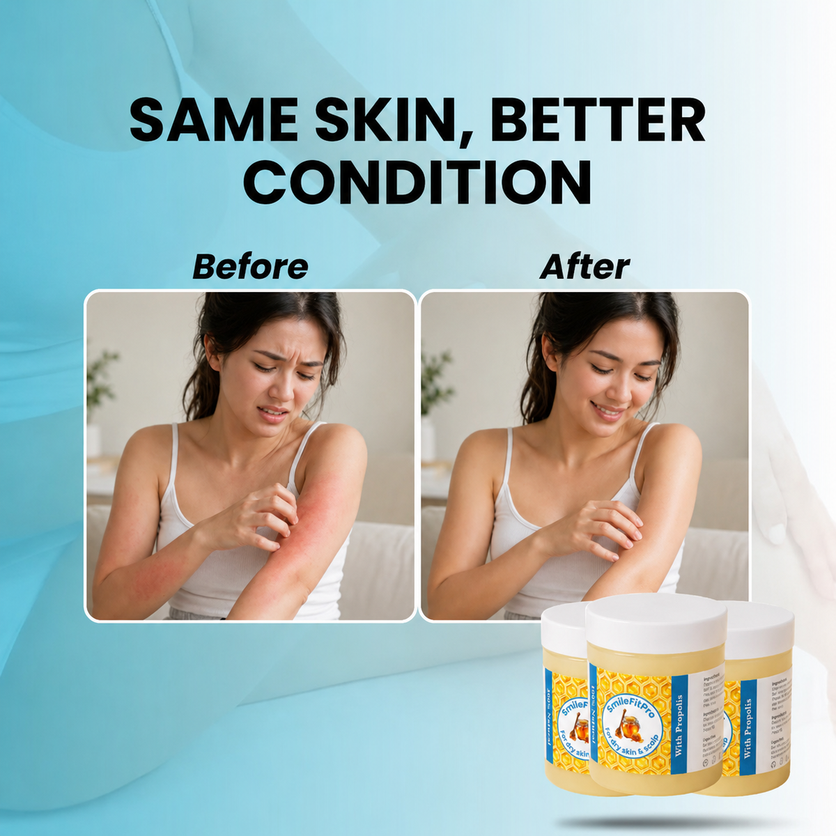 SmileFitPro - Repair Balm For Eczema & Psoriasis