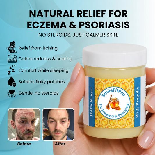 SmileFitPro - Repair Balm For Eczema & Psoriasis
