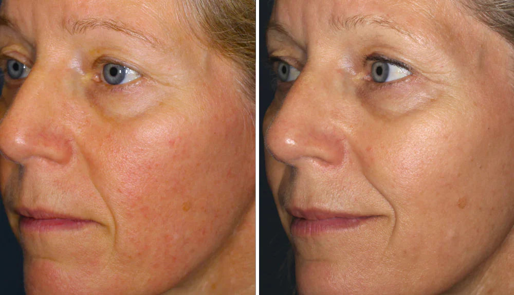 48H Redness Relief Cream – Calm & Restore Sensitive Skin