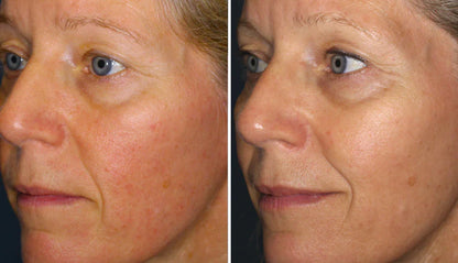 48H Redness Relief Cream – Calm & Restore Sensitive Skin