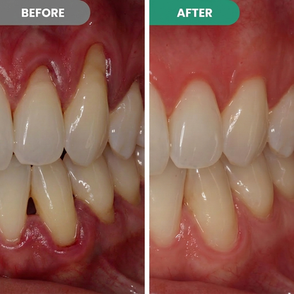 🔥 Pawzioo™ Gum & Enamel Repair Pen – Soothe Sensitive Gums & Support a Healthier Smile